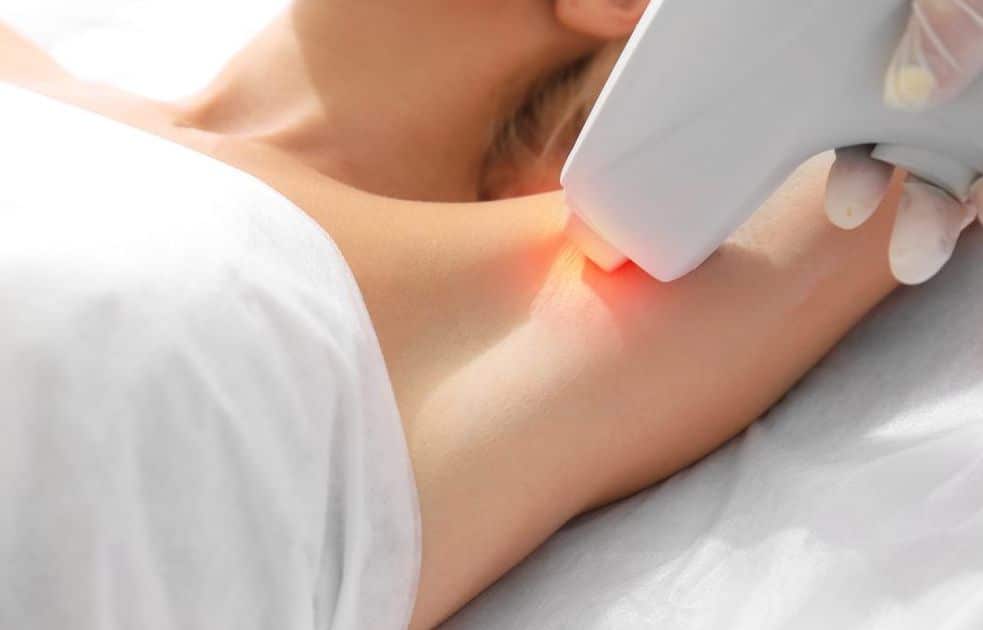 Depilación Láser con IPL