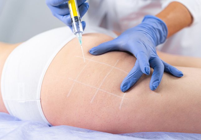 24_Mesoterapia_corporal