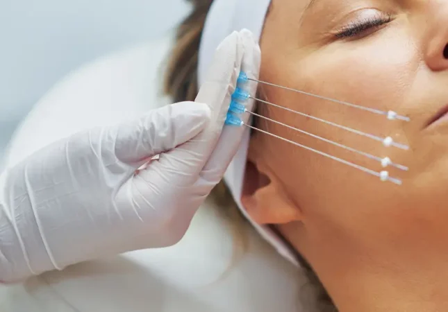 66634f7f7ef5d6d9fb39e607_hilos-rensores