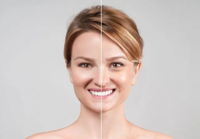 Cuánto-duran-los-efectos-del-Bótox