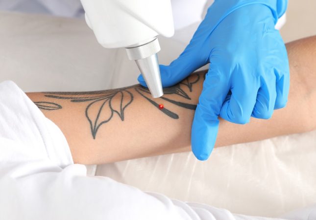 Woman undergoing laser tattoo removal procedure in salon, closeup
