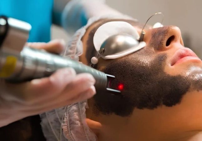 blog-hollywood-peel-870x563