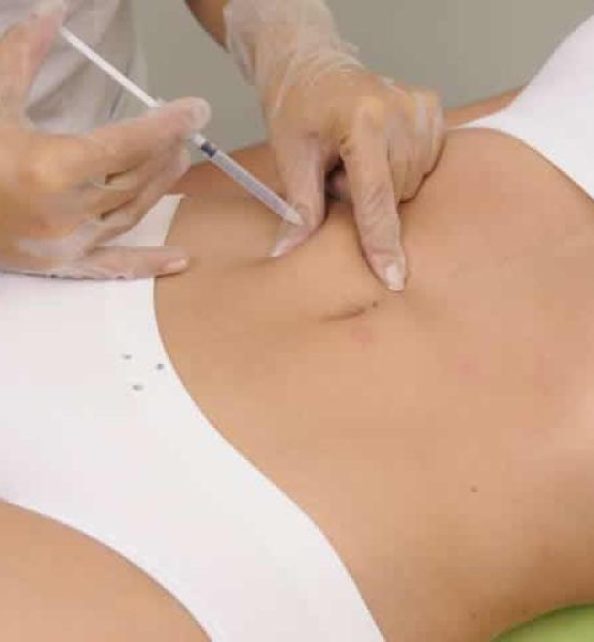 como_funciona_la_mesoterapia_25191_600_square