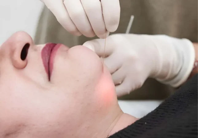 eliminar-papada-sin-cirugia-castellon-17395355781OeuY