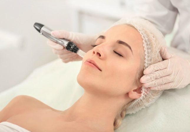 microneedling-1