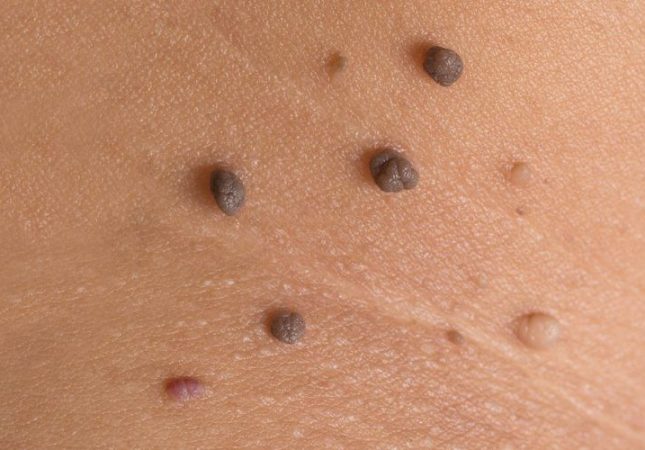 shutterstock_330939467-1-1000x500