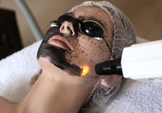 ¿Que-es-el-Hollywood-Peel-y-por-que-tantas-influencers-lo-estan-usando